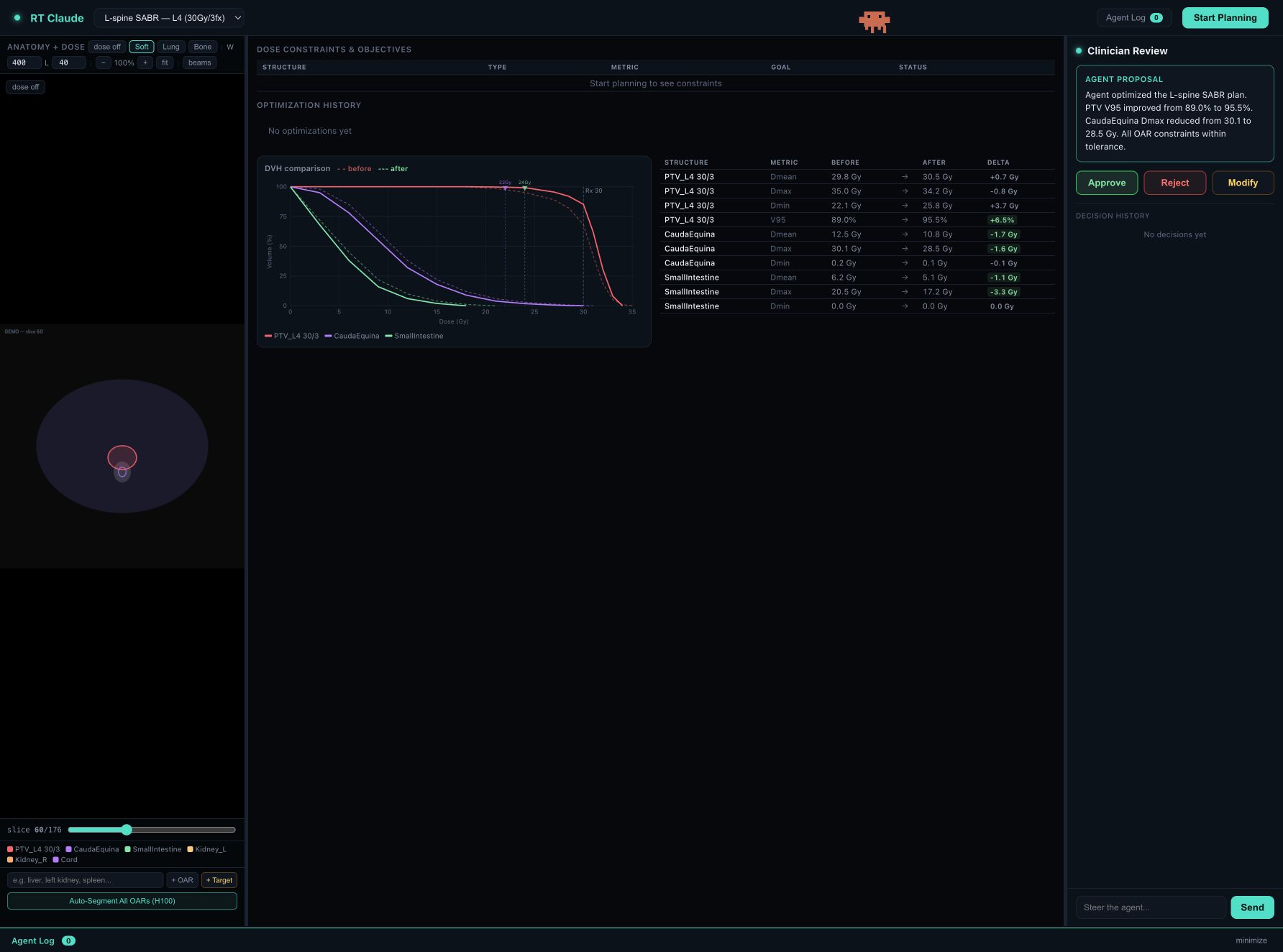 RT Claude planning review interface with DVH comparison and clinician approval controls